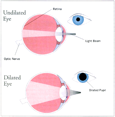 How do you know if you have pink eye?